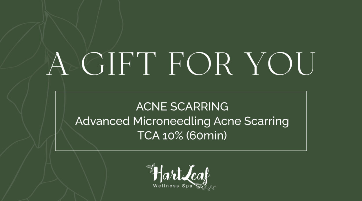 ACNE SCARRING – Advanced Microneedling Acne Scarring TCA 10% (60min)